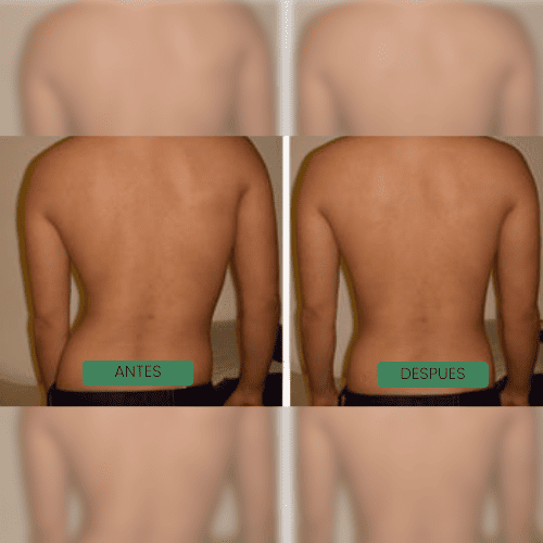 Davirae™ Corrector de postura instantáneo