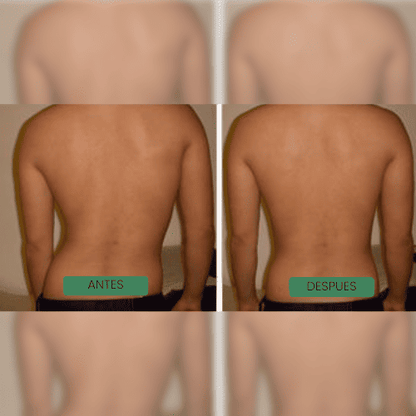 Davirae™ Corrector de postura instantáneo