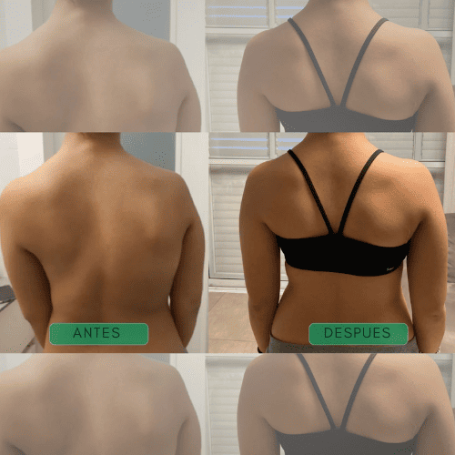 Davirae™ Corrector de postura instantáneo